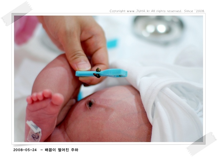 떨이진배꼽